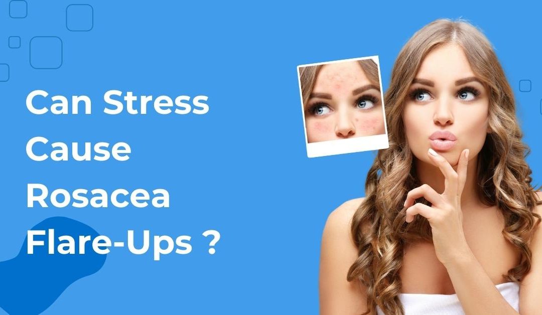 Can Stress Cause Rosacea Flare-Ups